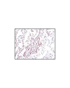 Cell Signaling Jak2 (D2e12) Xp Rabbit mAb