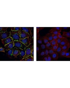 Cell Signaling Alpha-E-Catenin Antibody