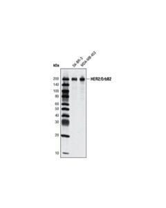 Cell Signaling Her2/Erbb2 (M45) Antibody