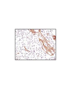 Cell Signaling Pdgf Receptor Alpha (D1e1e) Xp Rabbit mAb (Bsa And Azide Free)