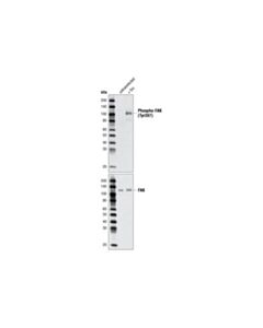 Cell Signaling Phospho-Fak (Tyr397) Antibody