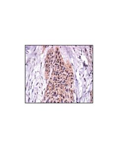 Cell Signaling Fak Antibody
