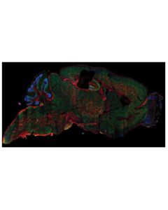 Cell Signaling Eea1 (C45b10) Rabbit mAb