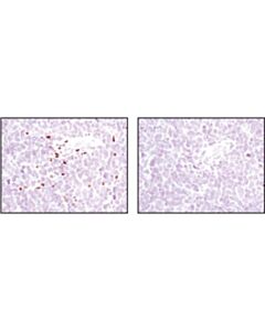 Cell Signaling 5-Lipoxygenase (C49g1) Rabbit mAb