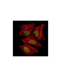 Cell Signaling Gcn5l2 (C26a10) Rabbit mAb