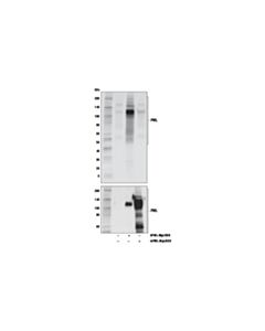 Cell Signaling Pml (E5r8t) Rabbit mAb