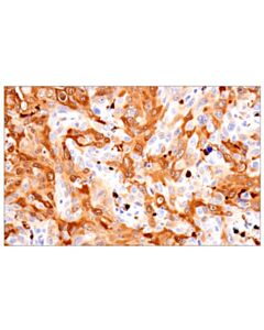 Cell Signaling S100A8 (F4R2W) Rabbit mAb
