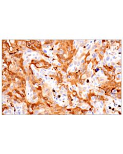 Cell Signaling S100A8 (F4R2W) Rabbit mAb 20 uL