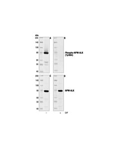 Cell Signaling Phospho-Alk (Tyr1604) Antibody