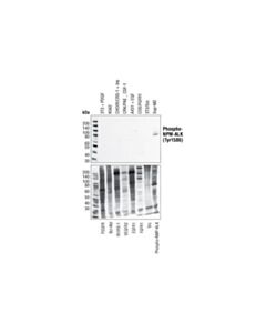 Cell Signaling Phospho-Alk (Tyr1586) Antibody