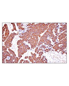 Cell Signaling Shmt2 (E7f4q) Rabbit mAb