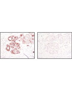 Cell Signaling Jak1 (6g4) Rabbit mAb