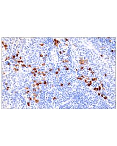 Cell Signaling Igg (Rwp49) Mouse mAb