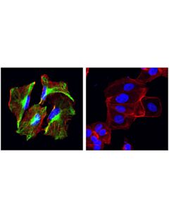 Cell Signaling Nestin (10c2) Mouse mAb