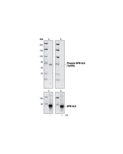 Cell Signaling Phospho-Alk (Tyr1586) (3b4) Rabbit mAb