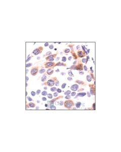 Cell Signaling Stathmin Antibody