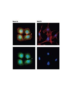 Cell Signaling Presynaptic Vesicle Cycle Antibody Sampler Kit