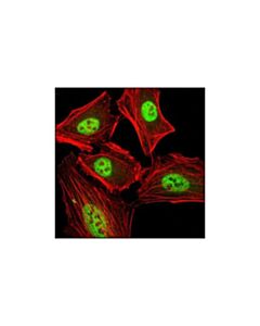 Cell Signaling Prmt4/Carm1 (C31g9) Rabbit mAb