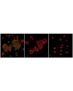Cell Signaling Non-Phospho (Active) Beta-Catenin (Ser33/37/Thr41) (D13a1) Rabbit mAb (BSA And Azide Free)