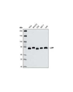 Cell Signaling LPP (8B3A11) Mouse mAb 20 uL