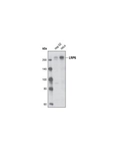 Cell Signaling Lrp6 (C47e12) Rabbit mAb