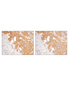 Cell Signaling Shp-2 (D50f2) Rabbit mAb