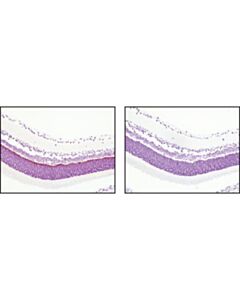 Cell Signaling Psd95 (D74d3) Xp Rabbit mAb