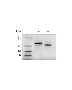 Cell Signaling Human Growth Hormone Recombinant Protein