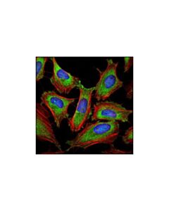 Cell Signaling Eif3a (D51f4) Xp Rabbit mAb
