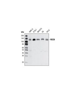 Cell Signaling Reck (D8c7) Rabbit mAb