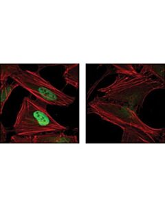Cell Signaling Hydroxy-Hif-1alpha (Pro564) (D43b5) Xp<Lt/>Sup&Gt;®<Lt/>/Sup&Gt; Rabbit mAb