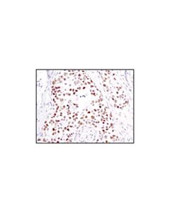 Cell Signaling Chk2 (1c12) Mouse mAb