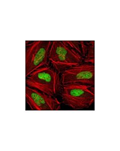 Cell Signaling Chk2 (1c12) Mouse mAb