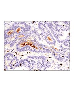 Cell Signaling S100a9 (D5o6o) Rabbit mAb (Ihc Formulated)