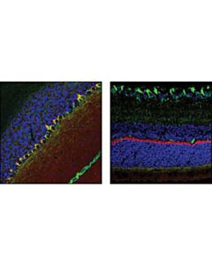 Cell Signaling Psd95 (D27e11) Xp Rabbit mAb