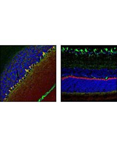 Cell Signaling Psd95 (D27e11) Xp Rabbit mAb