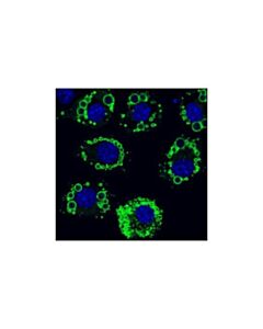Cell Signaling Perilipin-1 (K117) Antibody