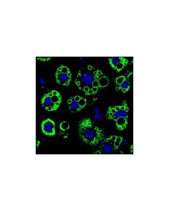 Cell Signaling Perilipin-1 (D418) Antibody