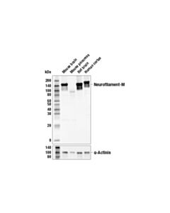Cell Signaling Neurofilament-M (E9N8K) Mouse mAb 20 uL