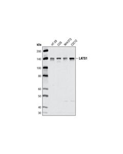 Cell Signaling Lats1 (C66b5) Rabbit mAb