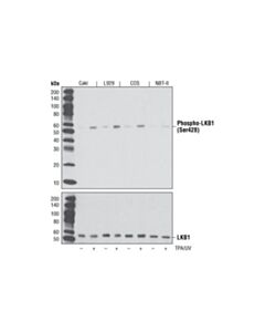Cell Signaling Phospho-Lkb1 (Ser428) (C67a3) Rabbit mAb