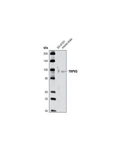 Cell Signaling Trpv3 Antibody