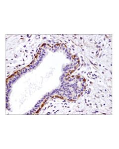 Cell Signaling Integrin Beta1 (D6s1w) Rabbit mAb
