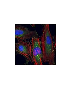 Cell Signaling Cortactin (H222) Antibody