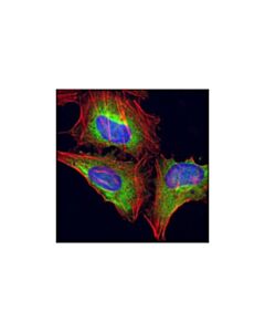 Cell Signaling Asymmetric-Methyl-Pabp1 (Arg455/Arg460) (C60a10) Rabbit mAb