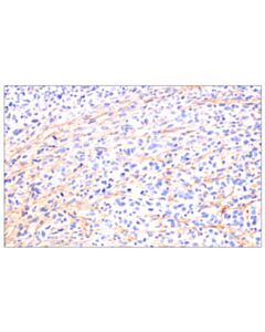 Cell Signaling Periostin (F7U5N) Rabbit mAb 100 µl
