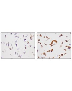 Cell Signaling Ampk Substrate Antibody Sampler Kit