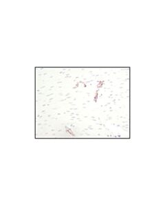 Cell Signaling Cd31 (Pecam-1) (89c2) Mouse mAb