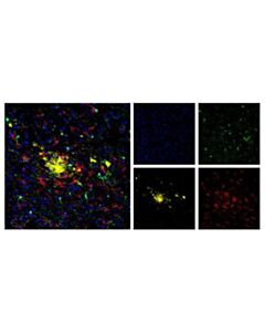 Cell Signaling Beta-Amyloid (D54d2) Xp<LT/>Sup&Gt;®<LT/>/Sup&Gt; Rabbit mAb (Alexa Fluor<LT/>Sup&Gt;®<LT/>/Sup&Gt; 594 Conjugate)