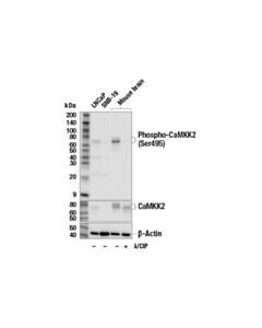 Cell Signaling Phospho-Camkk2 (Ser495) (E7w9s) Rabbit mAb